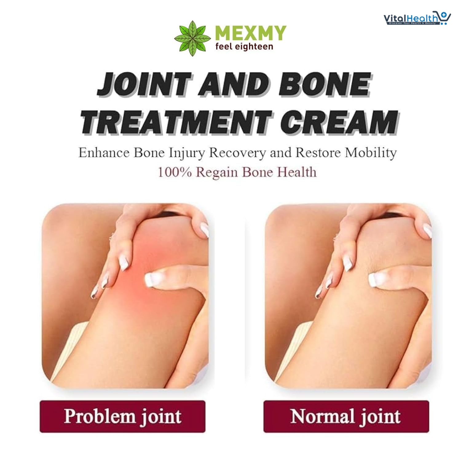 Perfectx Joint &amp; Bone Therapy Cream, Perfectx Intensive Joint &amp; Bone Therapy Cream, Intensive Concentrate for Joint and Muscle Recovery, Provides Relief for Back, Neck, Hands, Feet thumbnail 4