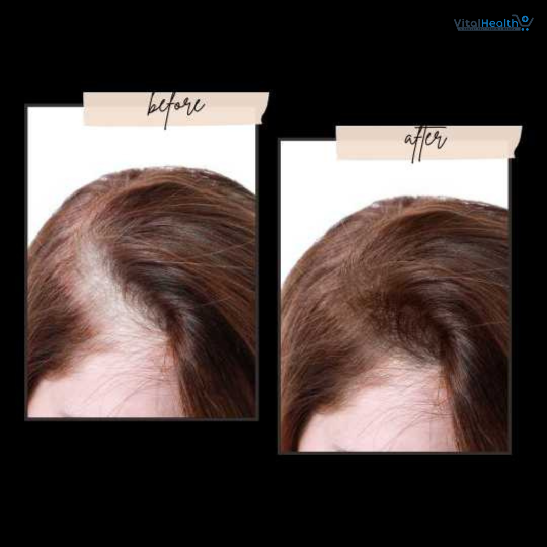 Toppik Hair Fiber Holding Spray, Instant Fuller Looking Hair thumbnail 2