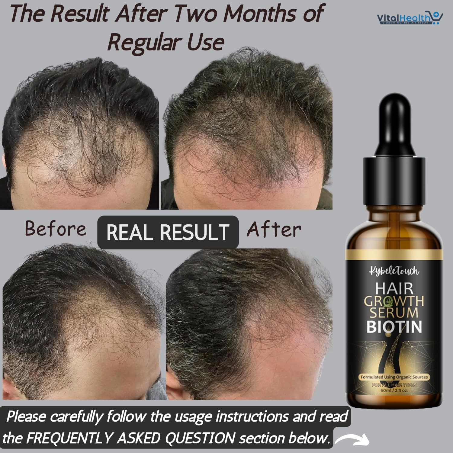 Hair Growth Serum 100% Natural Organic Hair Growth Oil with Biotin, Keratin, Caffeine, Rosemary, Castor, Argan, Coconut Oil, Hair Loss Treatment For Men,Women thumbnail 3
