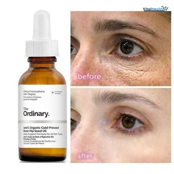 The Ordinary 100% Organic Cold-Pressed Rose Hip Seed Oil, Addresses Signs of Aging by Improving the Appearance of Uneven Skin Tone, Supporting Skin Elasticity, 1 Fl Oz thumbnail 3