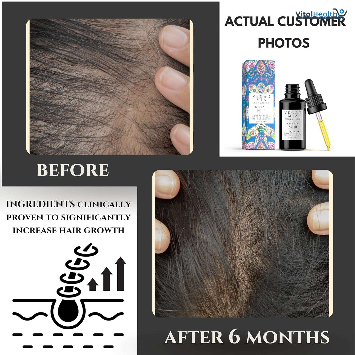 Vegan Mia Organic Rosemary Oil for Hair Growth &amp; Intense Nourishment with Castor, Jojoba, Argan, Amla &amp; More Dandruff &amp; Dry Scalp Treatment | Get Healthier, Shiny Hair Naturally, 1 fl oz thumbnail 4