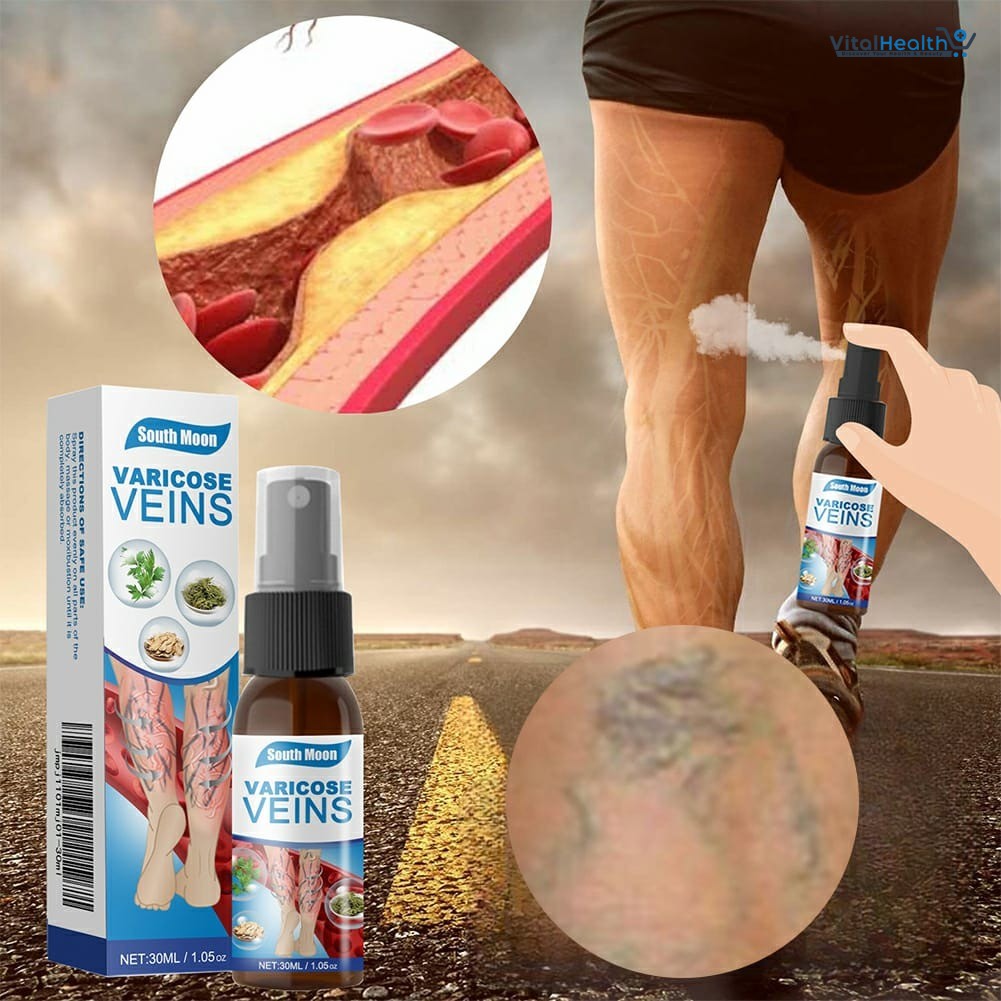 South Moon Varicose Veins Treatment Spray – 30ml Advanced Formula for Spider Veins, Leg Pain &amp; Swelling Relief | Natural Herbal Spray for Better Circulation thumbnail 4
