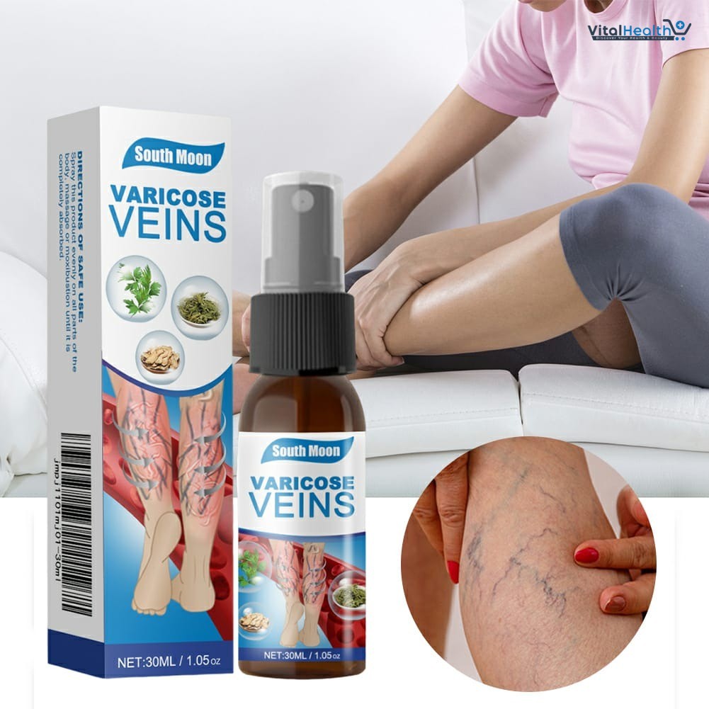 South Moon Varicose Veins Treatment Spray – 30ml Advanced Formula for Spider Veins, Leg Pain &amp; Swelling Relief | Natural Herbal Spray for Better Circulation thumbnail 5