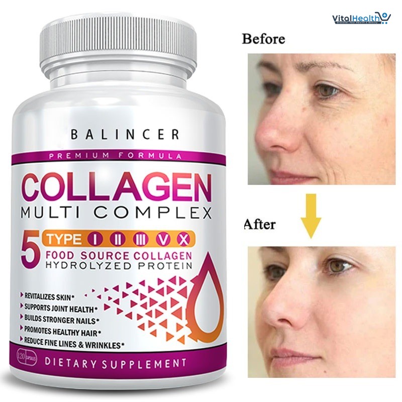 Balincer Collagen Multi Complex Capsules Brighten Skin Tone, Help Joint, Cartilage, Cardiovascular, Skin, Hair, Nails &amp; Digestive Health thumbnail 4