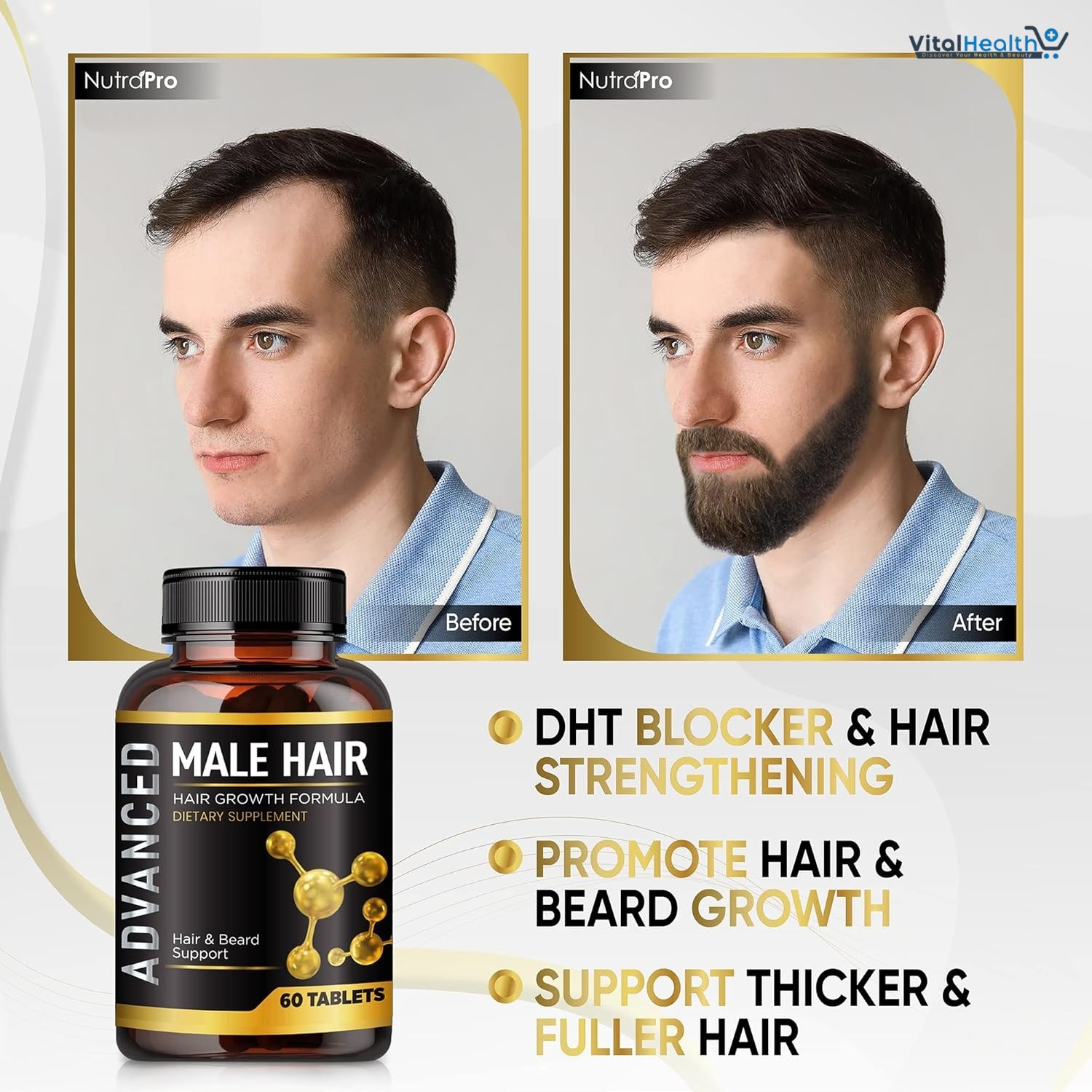 Hair Growth Vitamins With Biotin For Men-Anti Hair Loss Support Vitamins Pills thumbnail 4