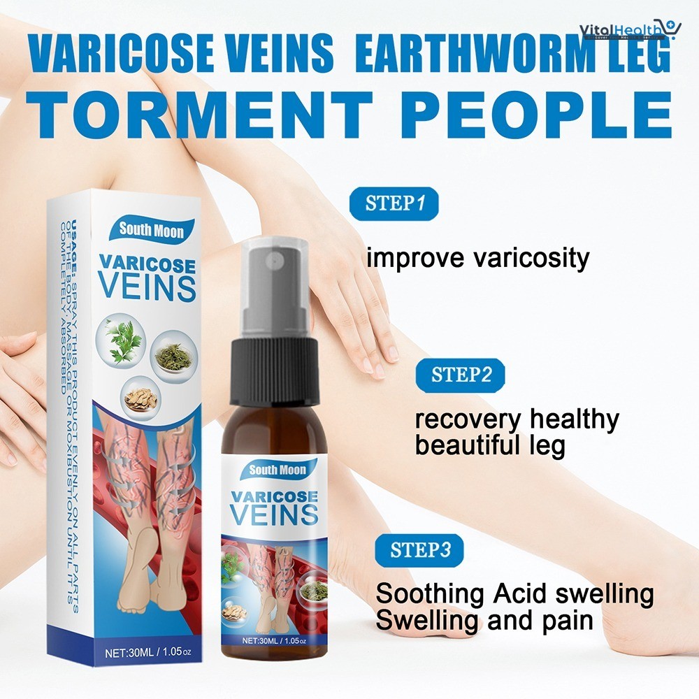 South Moon Varicose Veins Treatment Spray – 30ml Advanced Formula for Spider Veins, Leg Pain &amp; Swelling Relief | Natural Herbal Spray for Better Circulation thumbnail 2