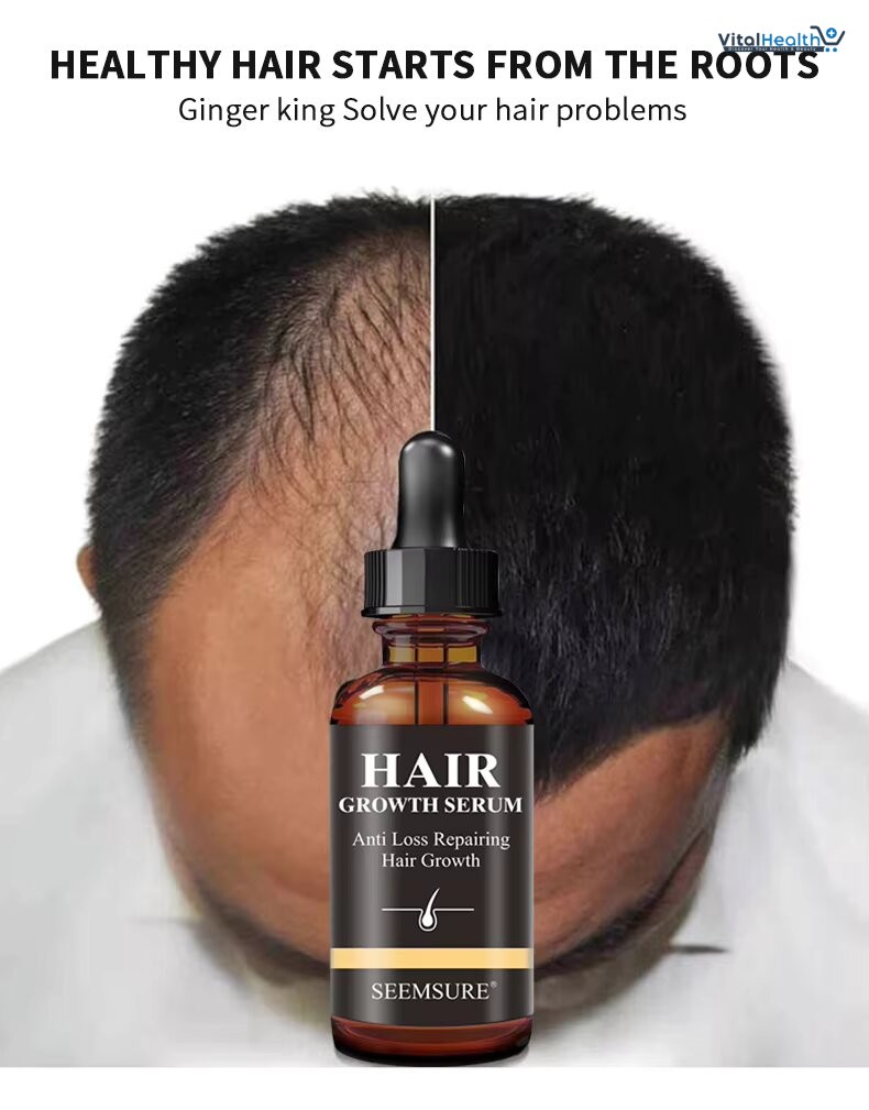 Seemsure Hair Growth Serum Anti Loss Repairing Hair Growth thumbnail 3
