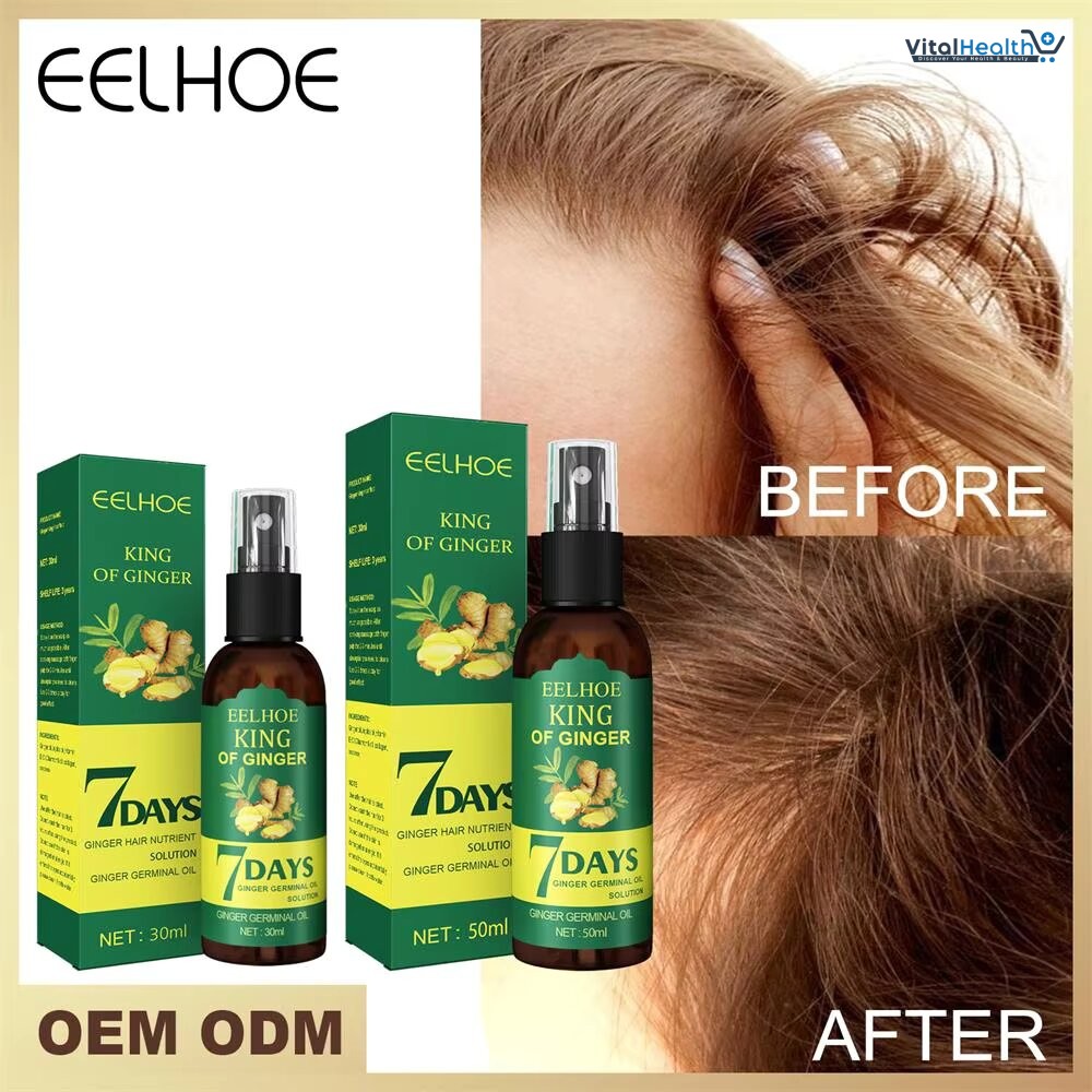 EELHOE King of Ginger 7 Days Ginger Germinal Hair Spray For Damaged Scalp Treatment and Hair Loss thumbnail 2
