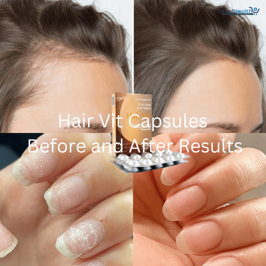 Hair Vut Capsules Healthy Hair Supports Nail Health and Growth, Boosts Immunity and Restores Energy Dietary Supplement 30 Capsules thumbnail 5