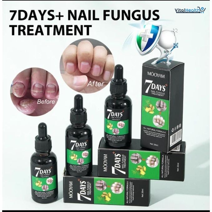 7 DAY Nail Fungus Treatment Nail Growth and Strengthening Serum All Natural Formula thumbnail 2