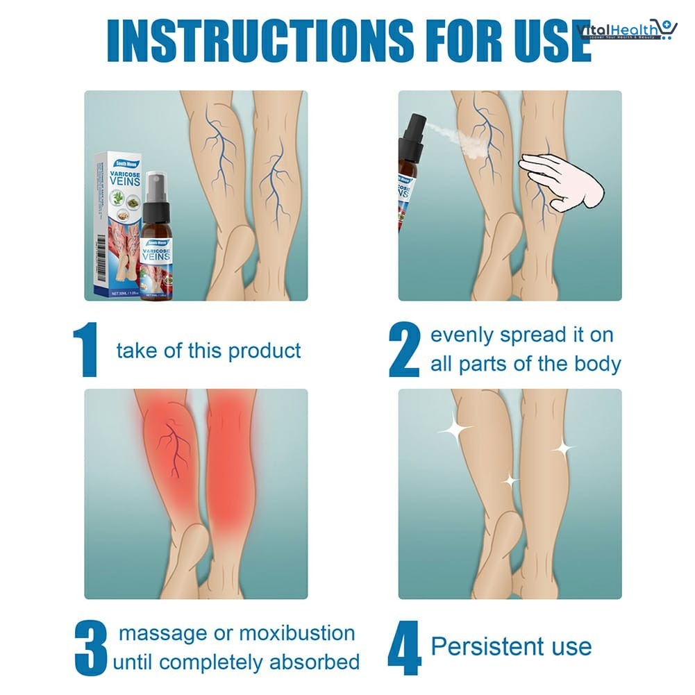 South Moon Varicose Veins Treatment Spray – 30ml Advanced Formula for Spider Veins, Leg Pain &amp; Swelling Relief | Natural Herbal Spray for Better Circulation thumbnail 6