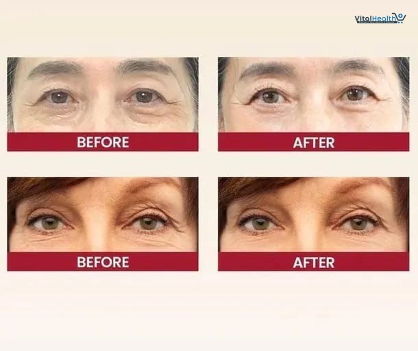 K-SECRET SEOUL 1988 Eye Cream: Retinal Liposome 2% + Fermented Black Bean - 30ml thumbnail 6