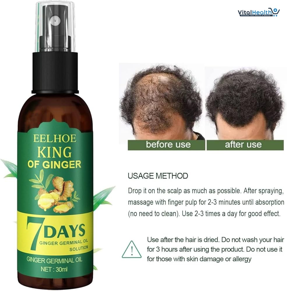 EELHOE King of Ginger 7 Days Ginger Germinal Hair Spray For Damaged Scalp Treatment and Hair Loss thumbnail 4