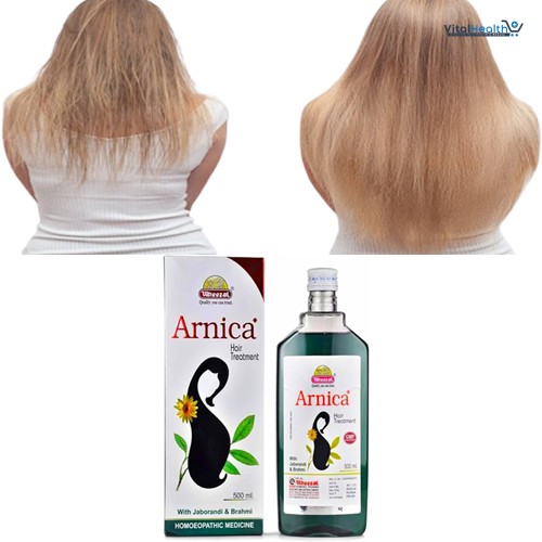 Arnica Hair Oil By Wheezal