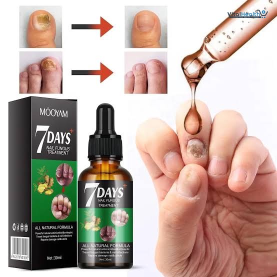 7 DAY Nail Fungus Treatment Nail Growth and Strengthening Serum All Natural Formula