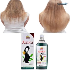 Arnica Hair Oil By Wheezal