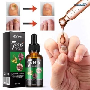 7 DAY Nail Fungus Treatment Nail Growth and Strengthening Serum All Natural Formula